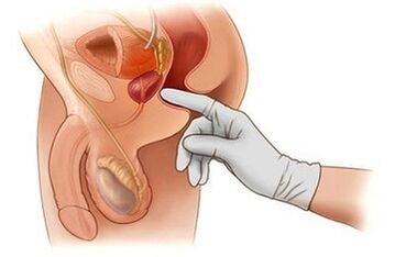 Masage prostat