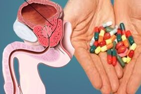 prostatit tedavisi için ilaçlar